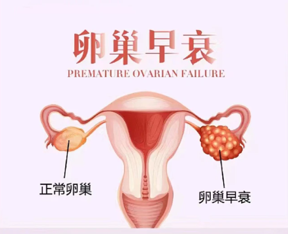 卵巢年龄≠生理年龄，您的卵巢“芳龄”几许？